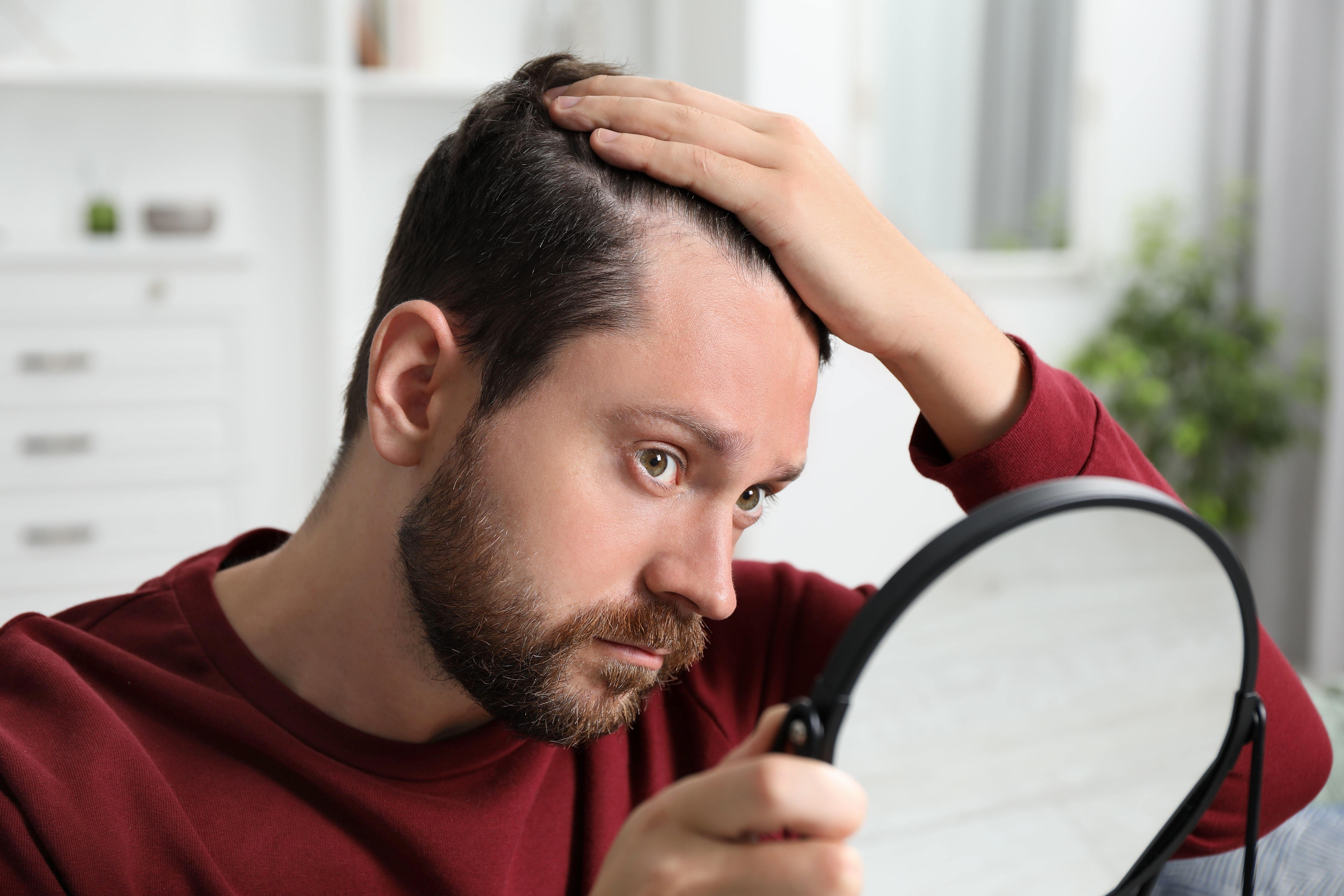 Can Your Thyroid Cause Hair Loss And Can It Be Treated?